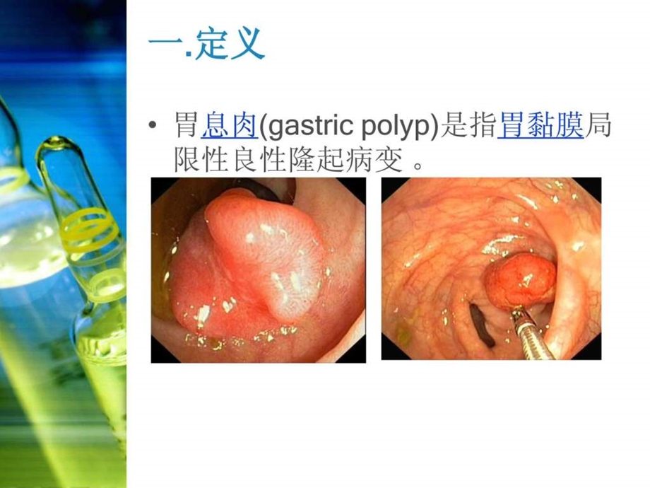 胃息肉内镜手术的护理图文.ppt.ppt_第3页