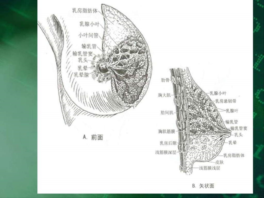 南昌大学超声精品课程之乳腺疾病1494218955.ppt_第3页