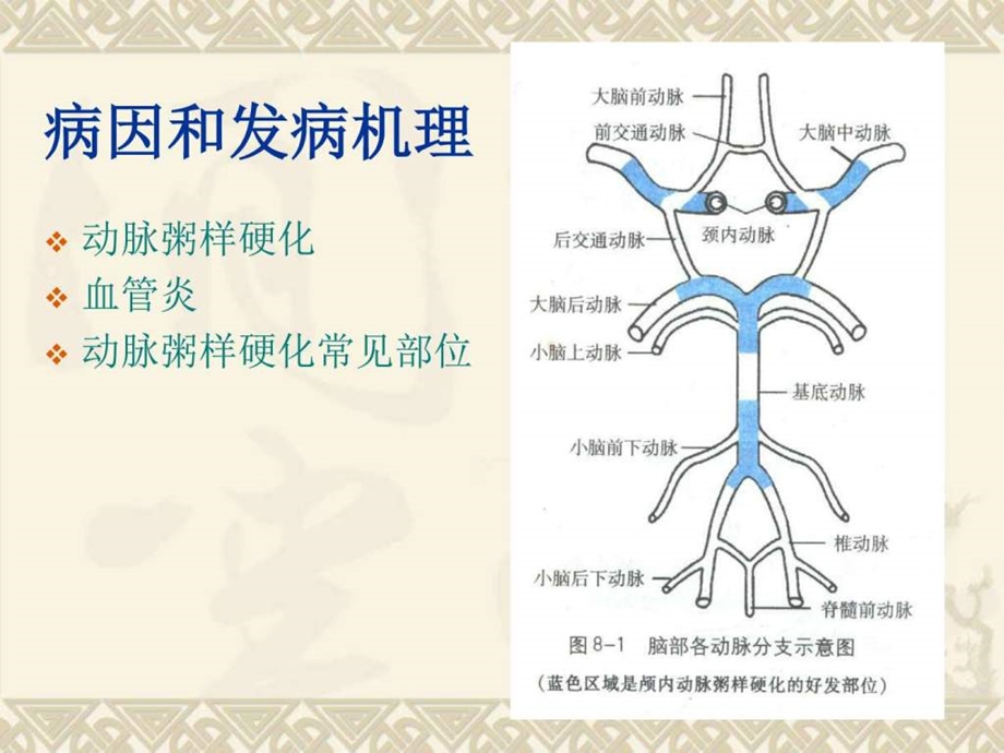 脑梗死图文1501947899.ppt.ppt_第3页