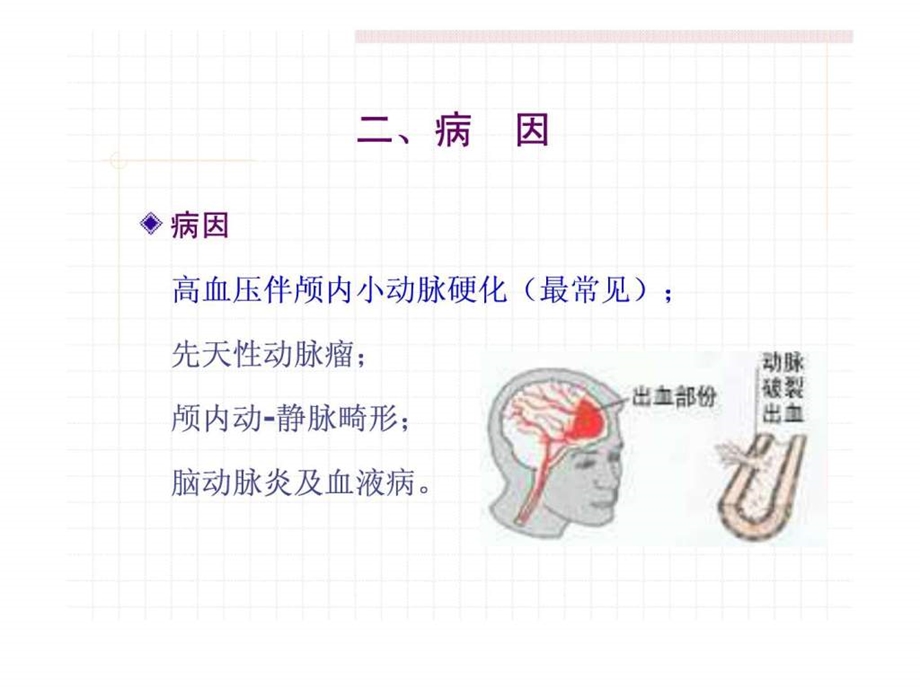 脑出血蛛网膜下腔出血护理.ppt.ppt_第2页