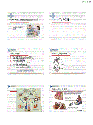 TORCH和TSH检测的临床应用.ppt