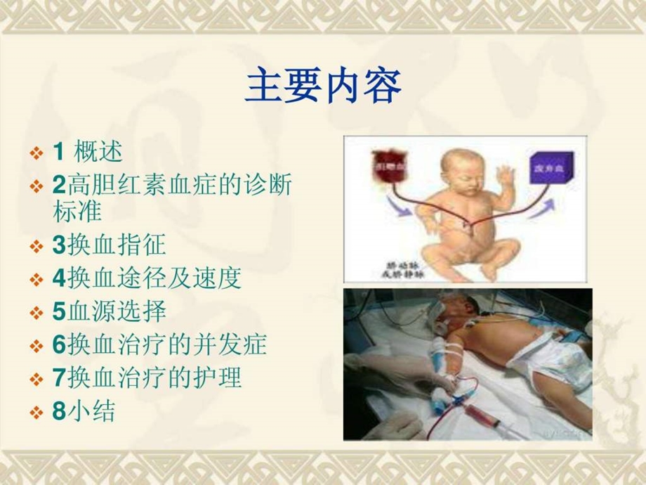 新生儿高胆红素血症换血图文.ppt.ppt_第2页