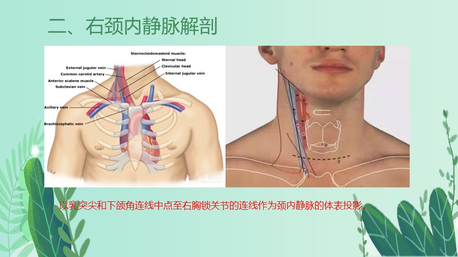 颈内静脉穿刺置管术.pptx_第3页