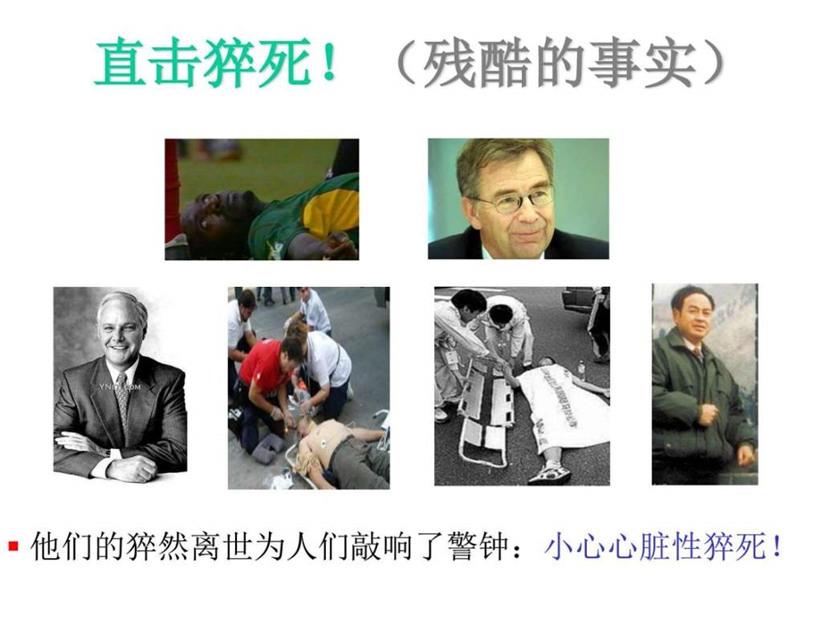 心脏性猝死的预防图文.ppt.ppt_第2页