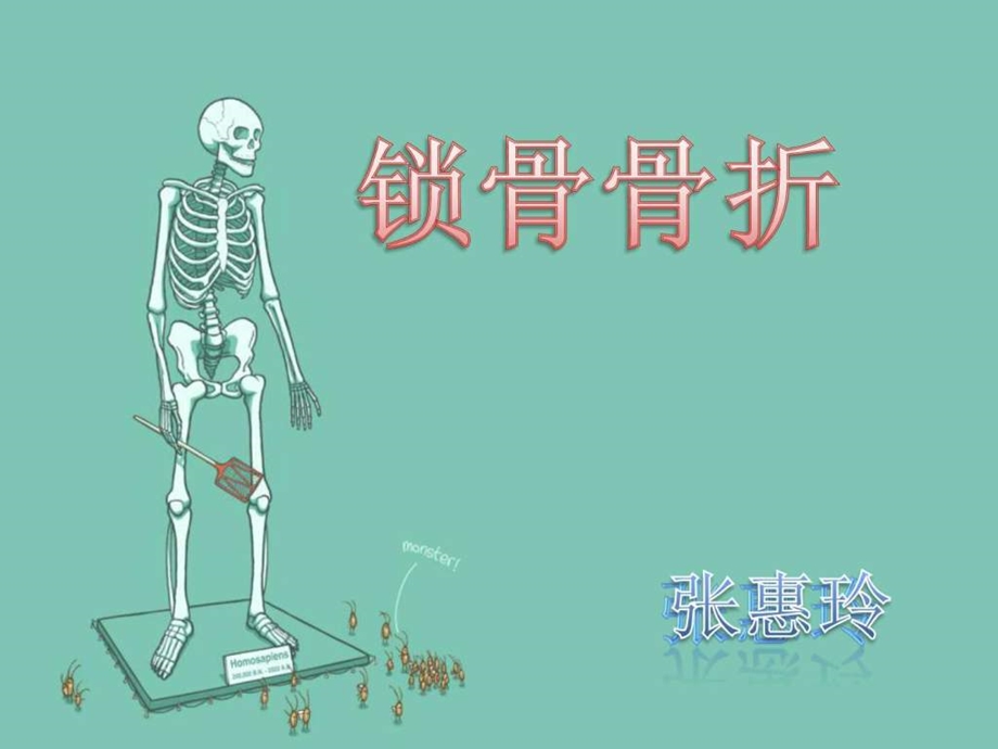 锁骨骨折图文.ppt.ppt_第1页