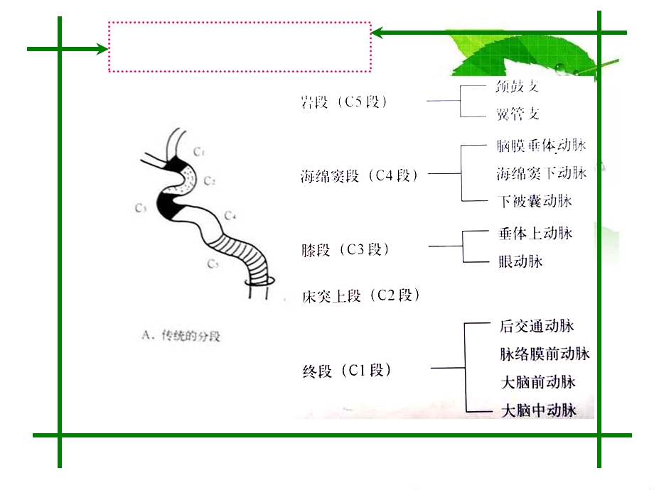 头颈部血管的CTAMRA诊断.ppt_第3页