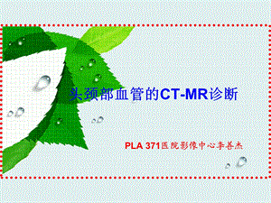 头颈部血管的CTAMRA诊断.ppt