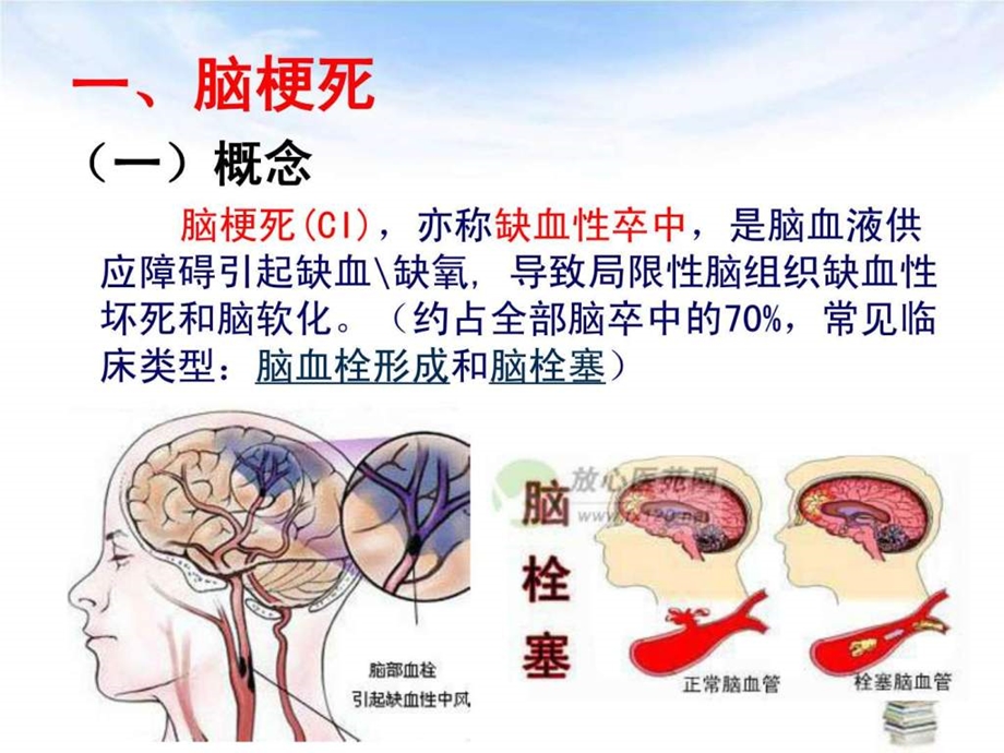 脑梗死相关护理知识.ppt.ppt_第3页