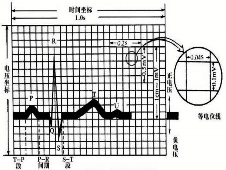 叫你怎样入门看正常心电图调查报告表格模板实用文档.ppt.ppt_第2页