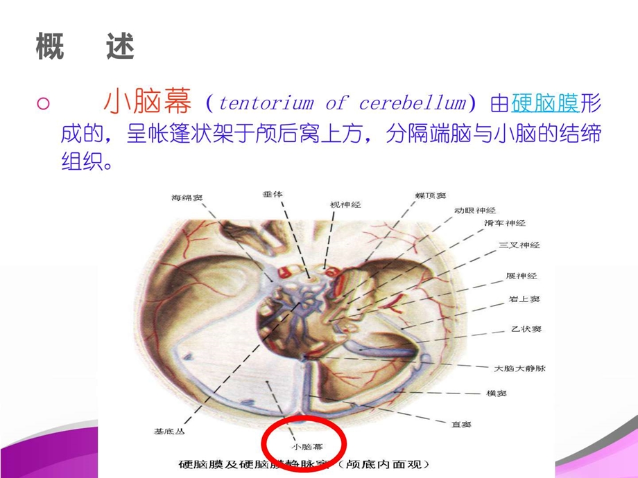 幕下肿瘤的护理护理专业培训课件图文.ppt_第3页