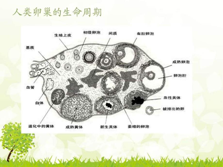 卵巢黄体破裂出血护理查房图文.ppt.ppt_第3页