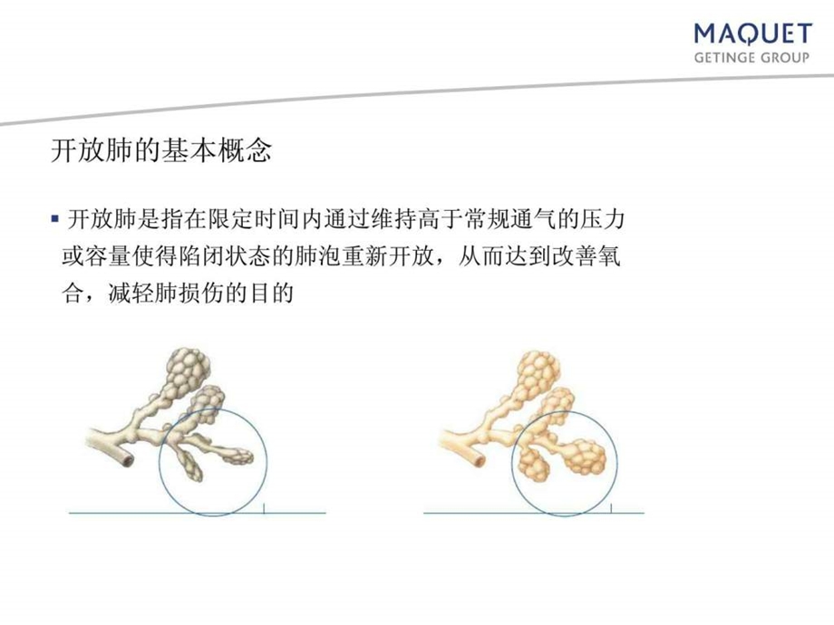 国外肺复张精品中文.ppt_第3页