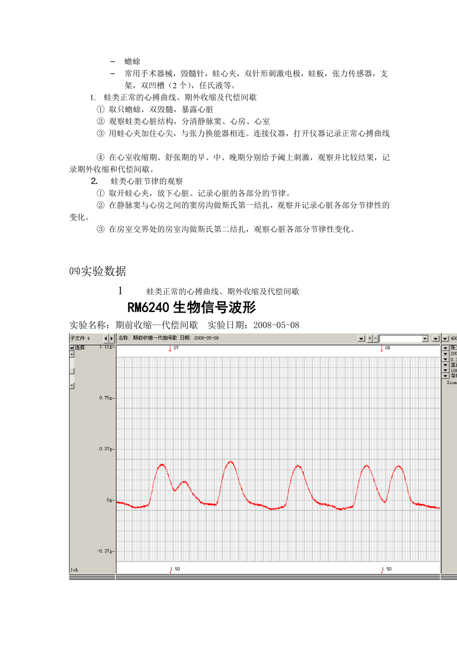 期前收缩和代偿间歇.doc_第3页