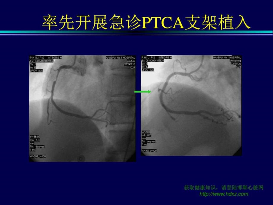 冠心病的正确诊断及治疗新策略图文.ppt.ppt_第3页