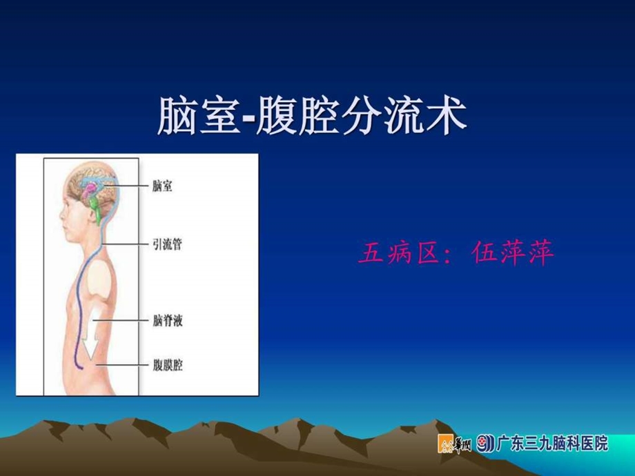 脑室腹腔分流术.ppt.ppt_第1页