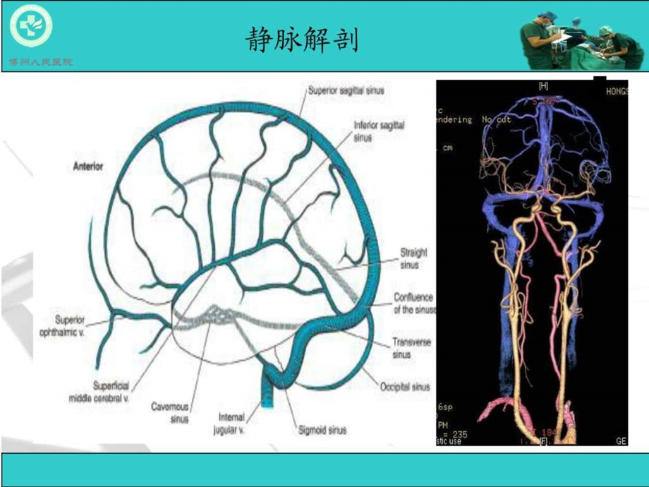 脑血管疾病CTA诊断图文.ppt.ppt_第2页