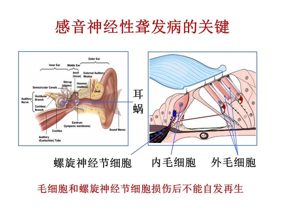 国产人工耳蜗的研制和临床验证现状.ppt_第2页