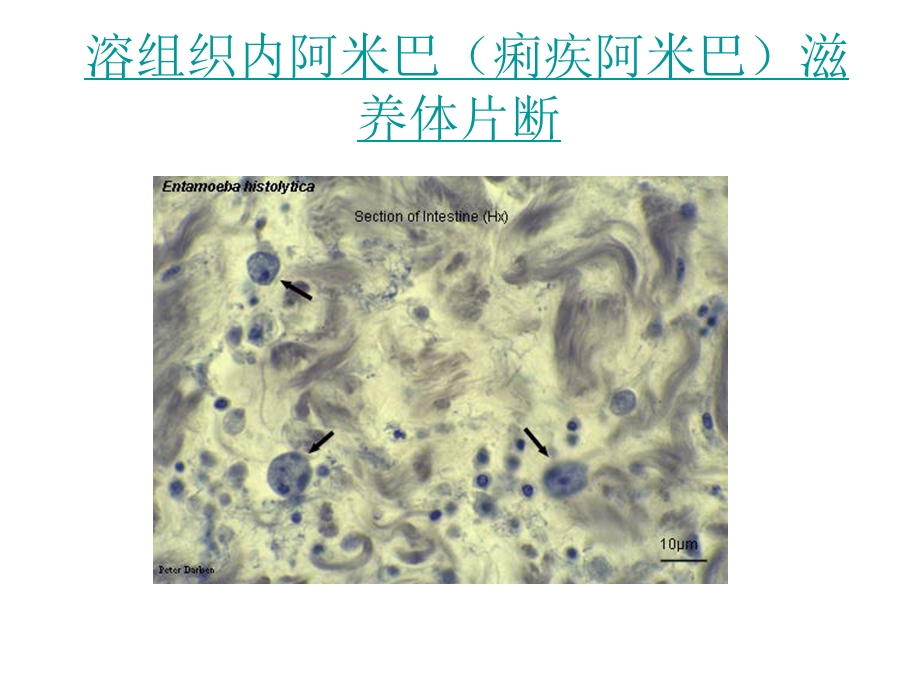 常见寄生虫图谱.ppt_第3页