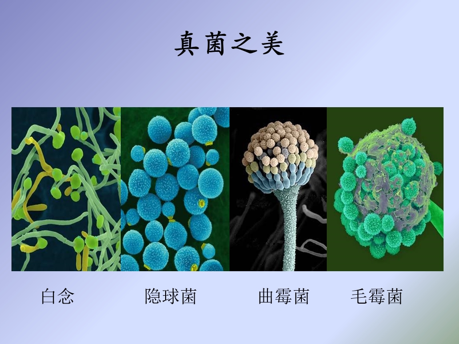 常见抗真菌药物的特点.ppt_第2页