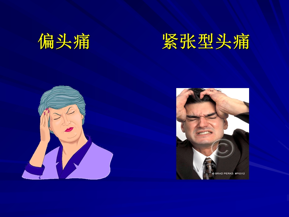 常见头痛的治疗.ppt_第2页