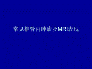 常见椎管内肿瘤及MRI表现.ppt