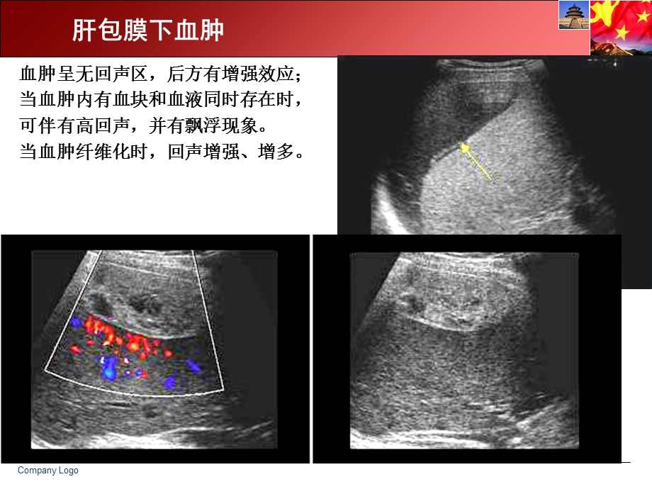 急诊超声的检查与分析.ppt_第3页