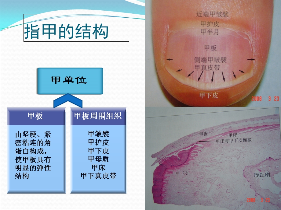 常见皮肤病的指甲表现.ppt_第2页