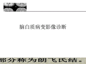 白质病变影像诊断 .ppt