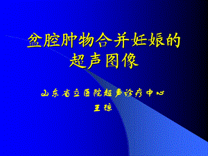 盆腔肿物合并妊娠的超声.ppt