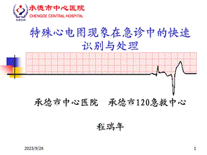 特殊心电图现象在急诊中的快速识别.ppt