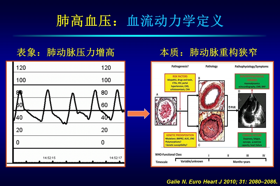 蒋鑫同济大学附属上海市肺科医院心肺血管中心0924.ppt_第3页