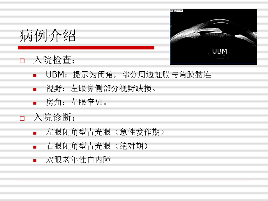 恶性青光眼病例分析.ppt_第3页