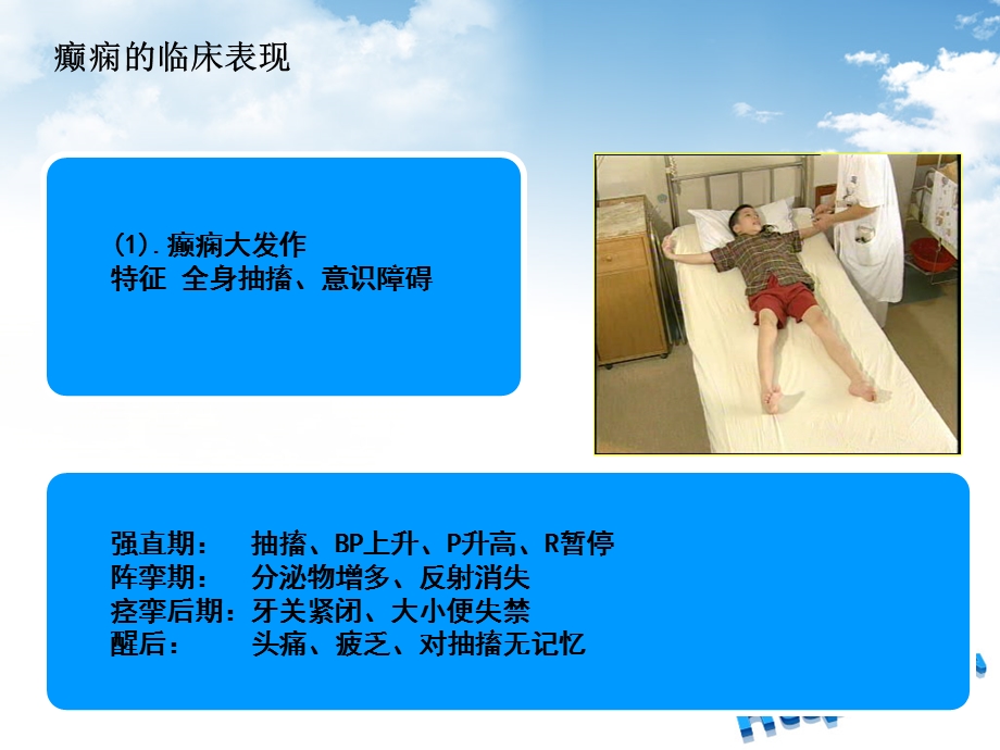 癫痫临床表现及护理.ppt_第1页