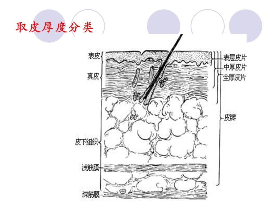 烧伤供皮区创面应用.ppt_第2页