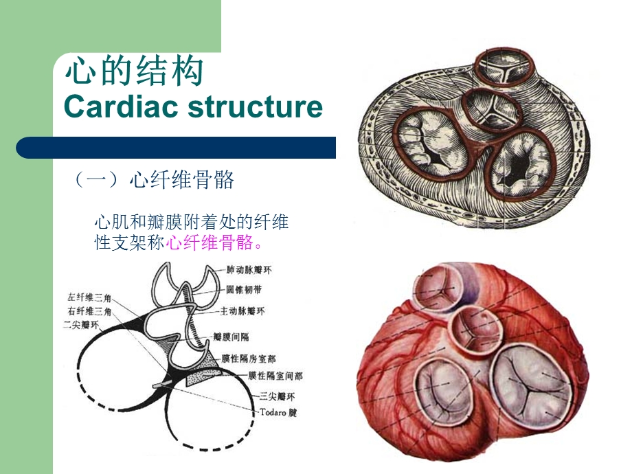 心脏肿瘤CT诊断.ppt_第3页