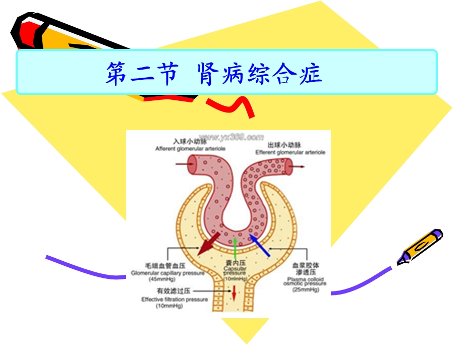 肾病综合症护理.ppt_第2页