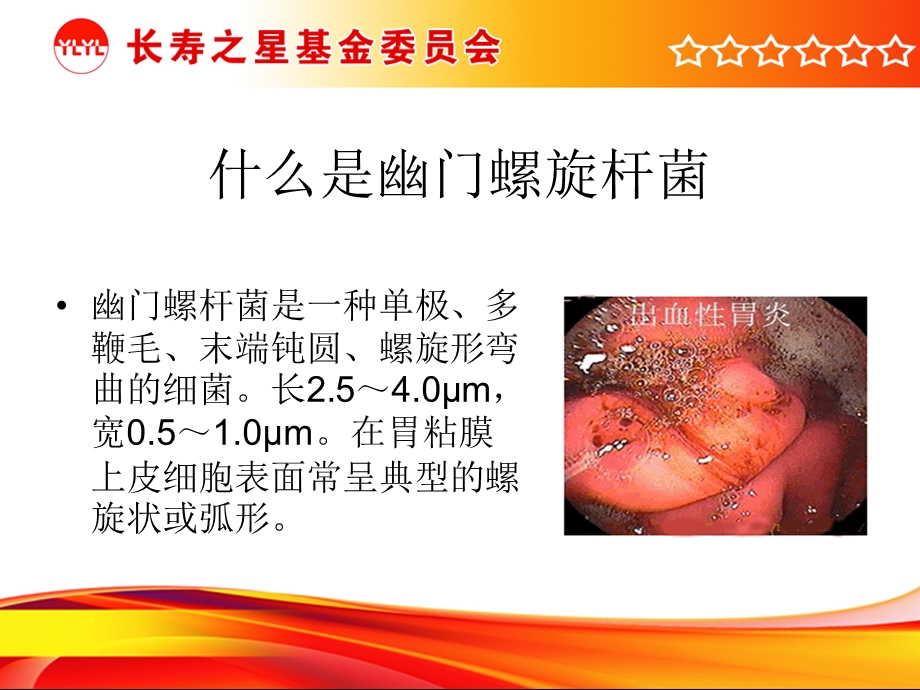 认识幽门螺旋杆菌.ppt_第2页