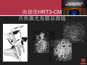 海德堡hrt共焦激光角膜显微镜 ppt课件.ppt