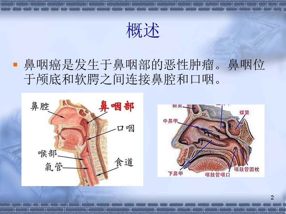 防治鼻咽癌的中药.ppt_第2页