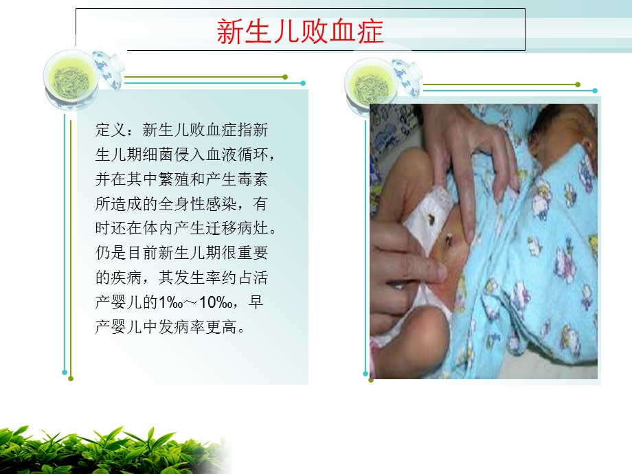 《败血症护理》ppt课件.ppt_第2页