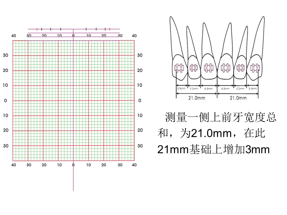 弓丝训练1ppt课件.ppt_第2页