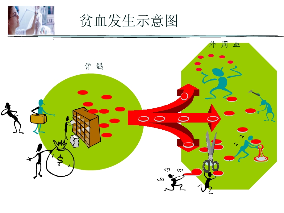 《贫血概述》课件.ppt_第2页