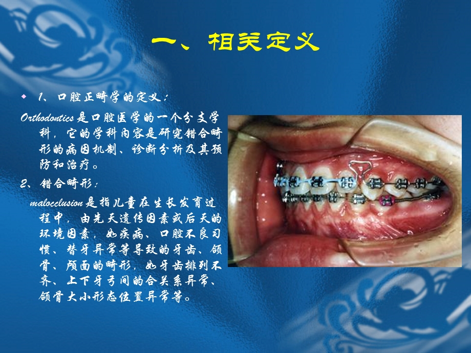 口腔正畸学第一章绪论.ppt_第3页