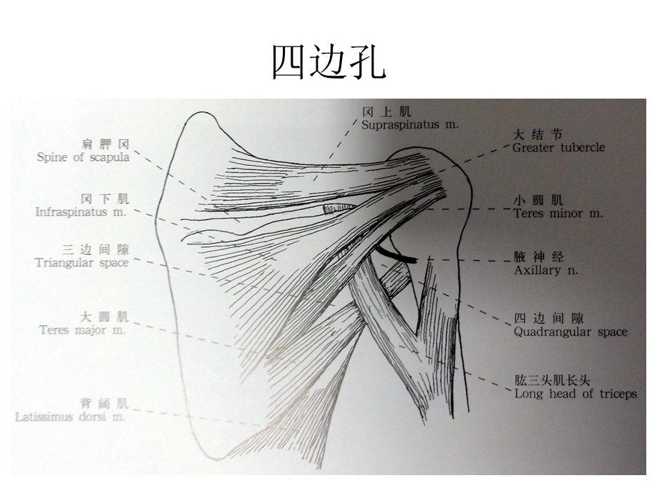 四边孔综合征.ppt_第3页