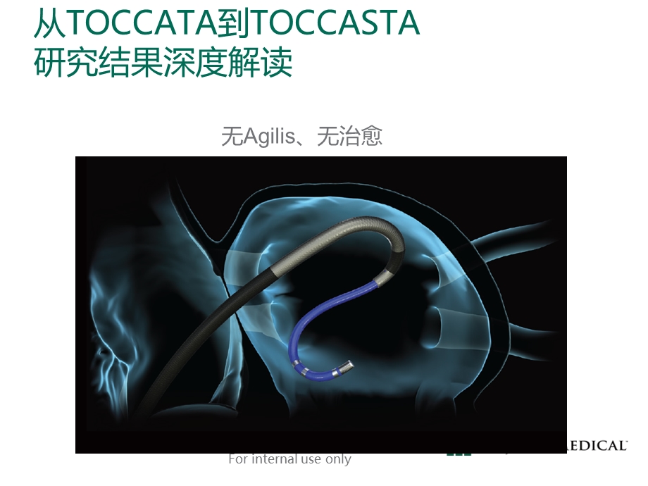 可调弯鞘贴靠强度效果.ppt_第1页