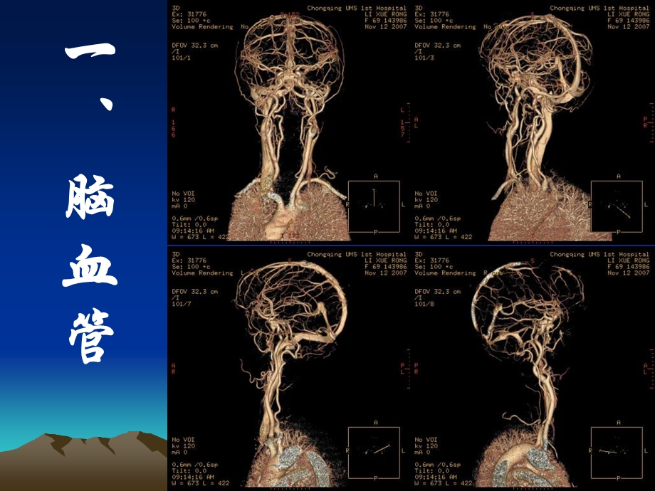 头部三维断层解剖B.ppt_第3页