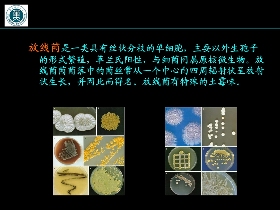 实验十一放线菌形态的观察.ppt_第3页