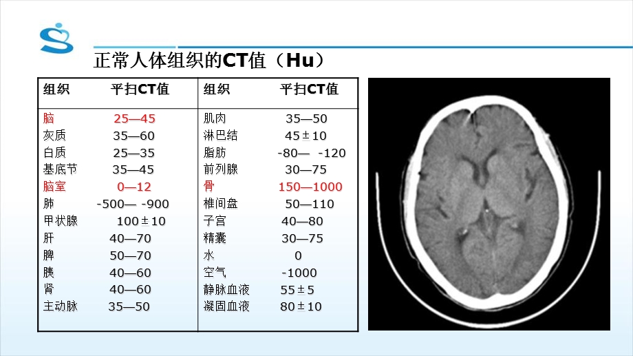 头颅ct基本知识及神经外科常见疾病ct读.ppt_第3页