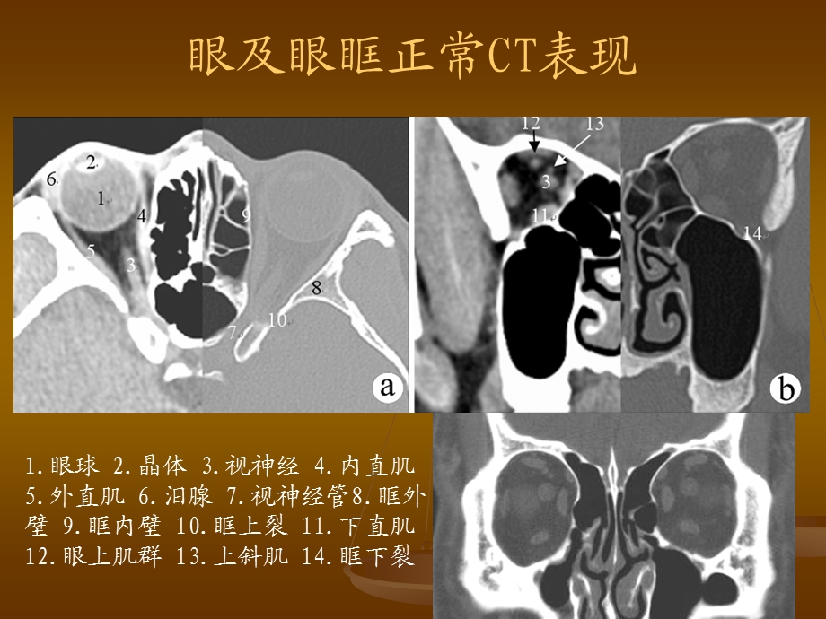 影像诊断学实习 头颈部实习.ppt_第3页