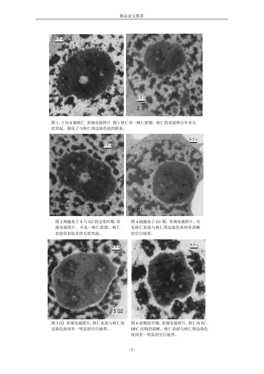 洋葱核仁的超微结构动态变化特征和 rRNA 转录1【精品论文大全】 .doc_第3页